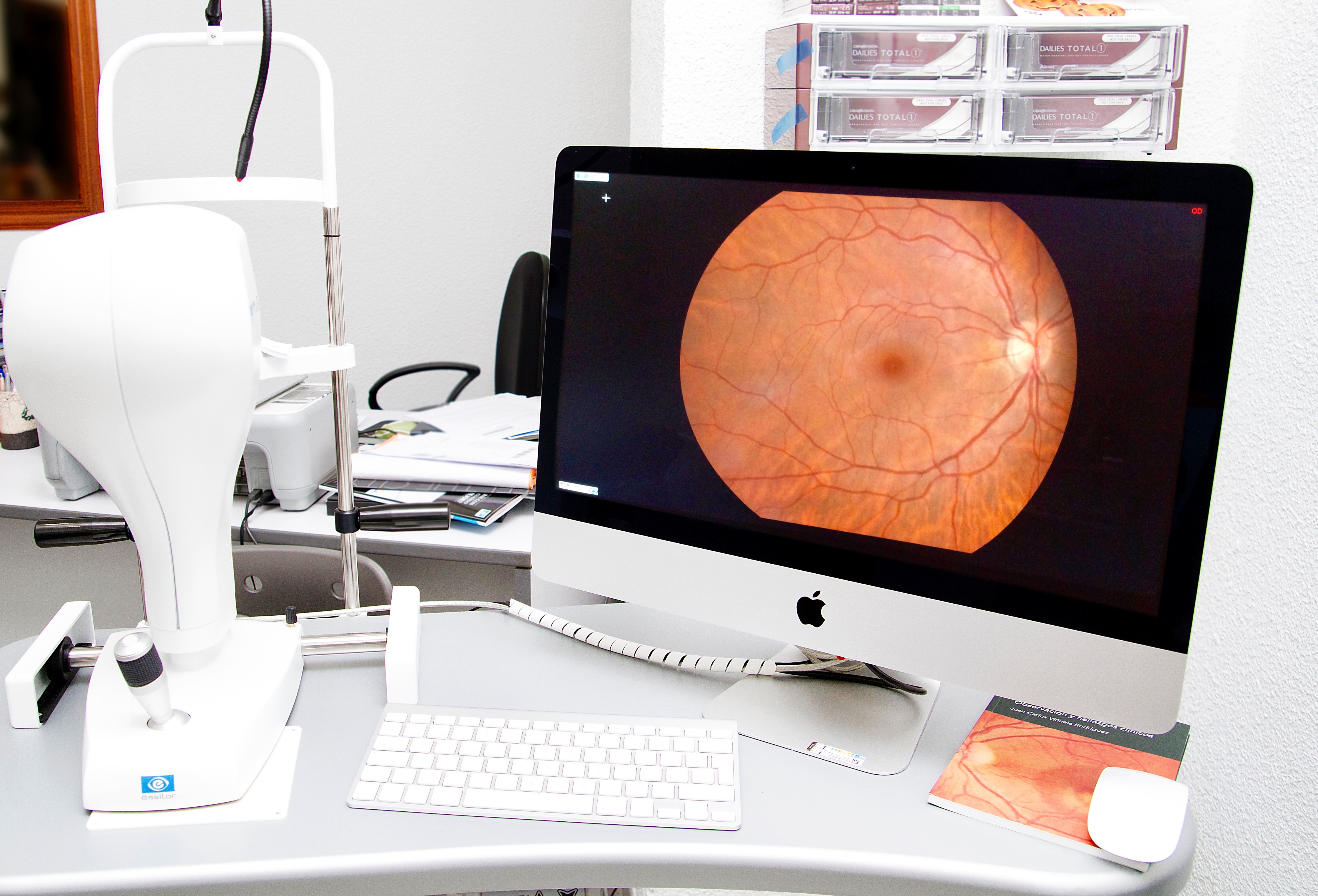 retinografo-ojo-oftalmologo