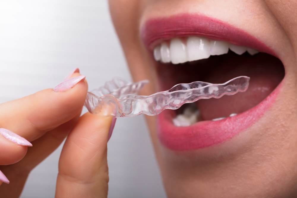ferula-dental
