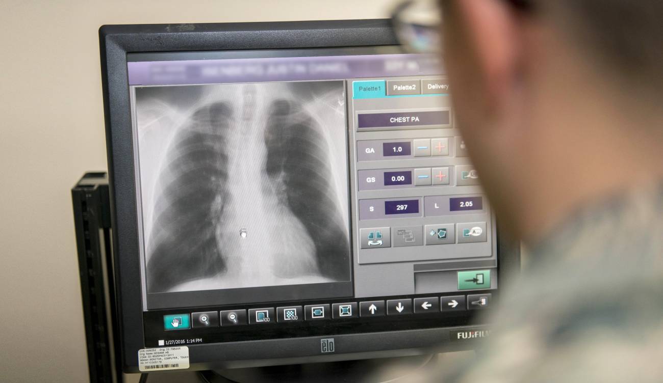 radiografia-torax