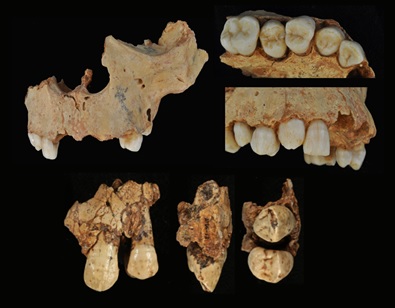 Caninos permanentes de H. antecessor. En la fila superior, maxilar del individuo H3, en la fila inferior, canino maxilar izquierdo del individuo H1/Cecilia García-Campos