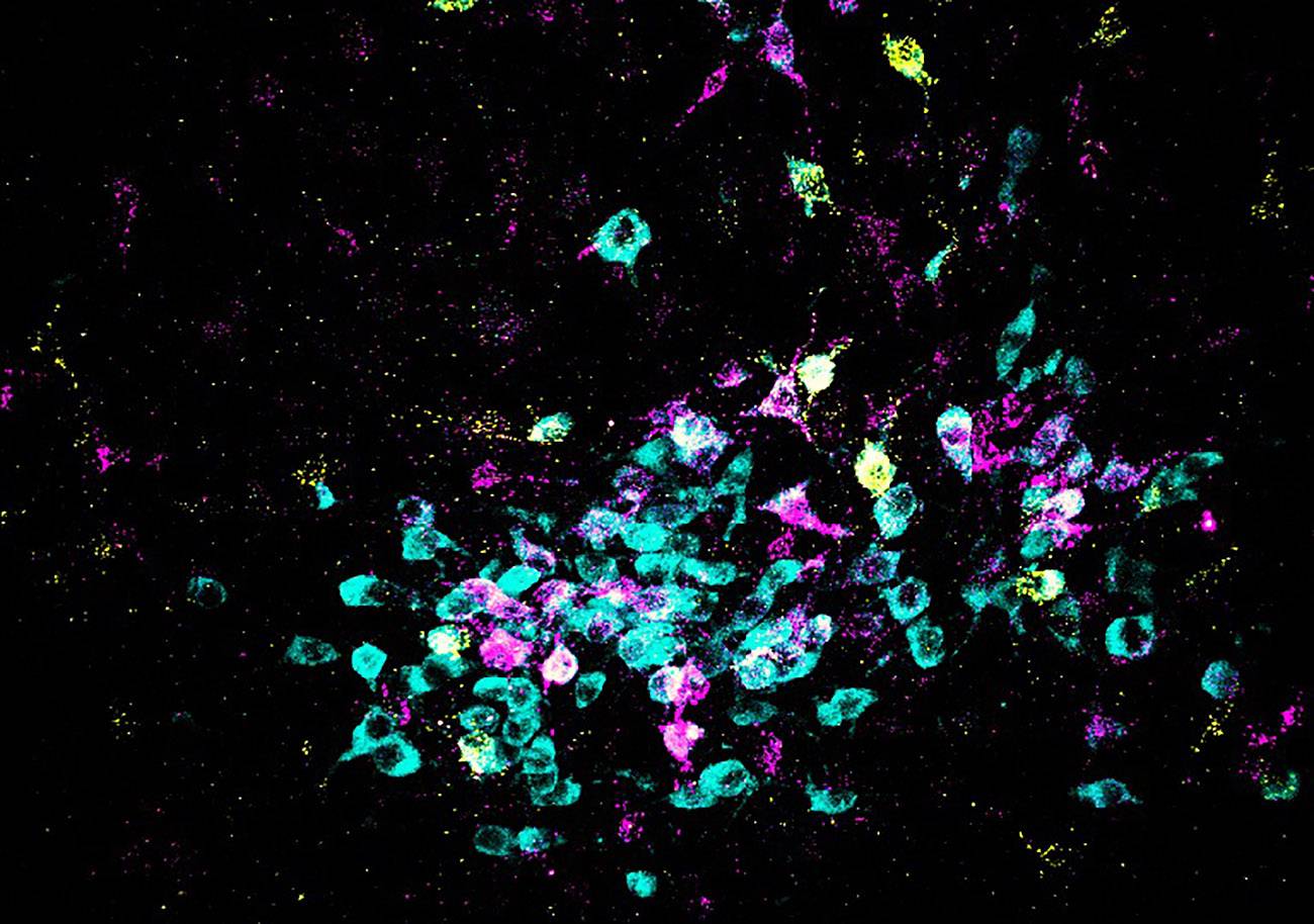 Neuronas